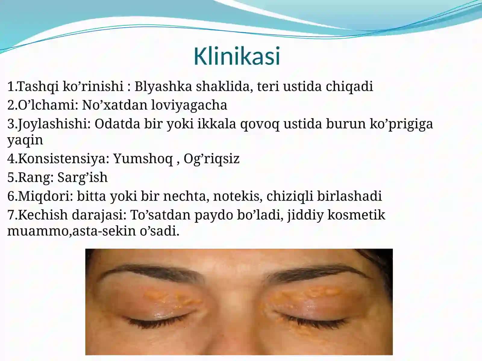 Ksantelazma.Lipoma.Gigroma 4