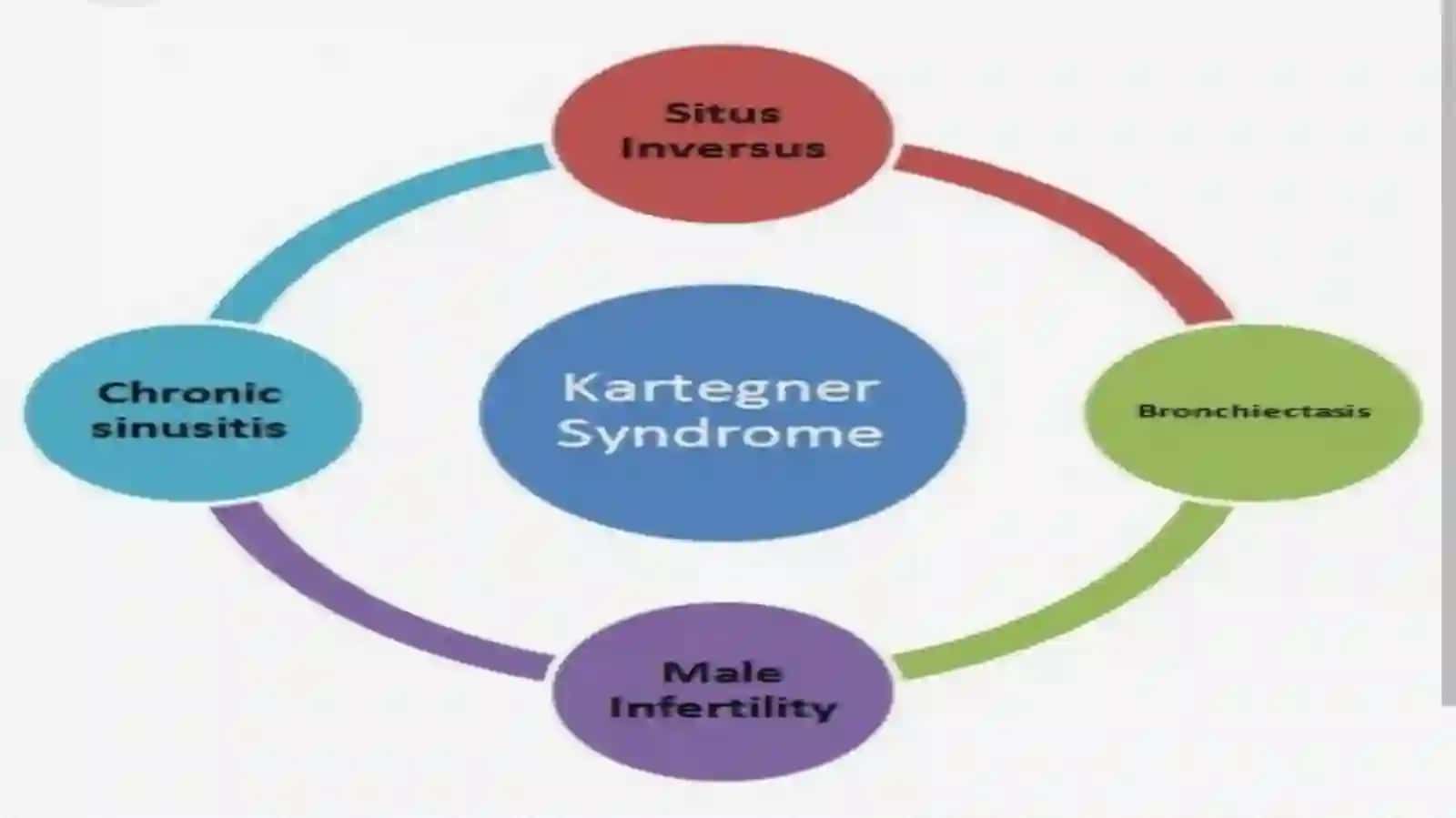 KARTAGENER SINDROMI 4
