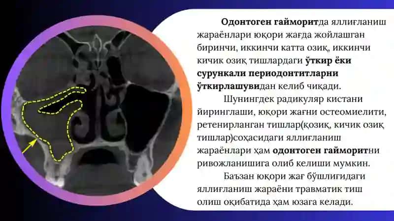 ODONTOGEN GAYMORIT 4