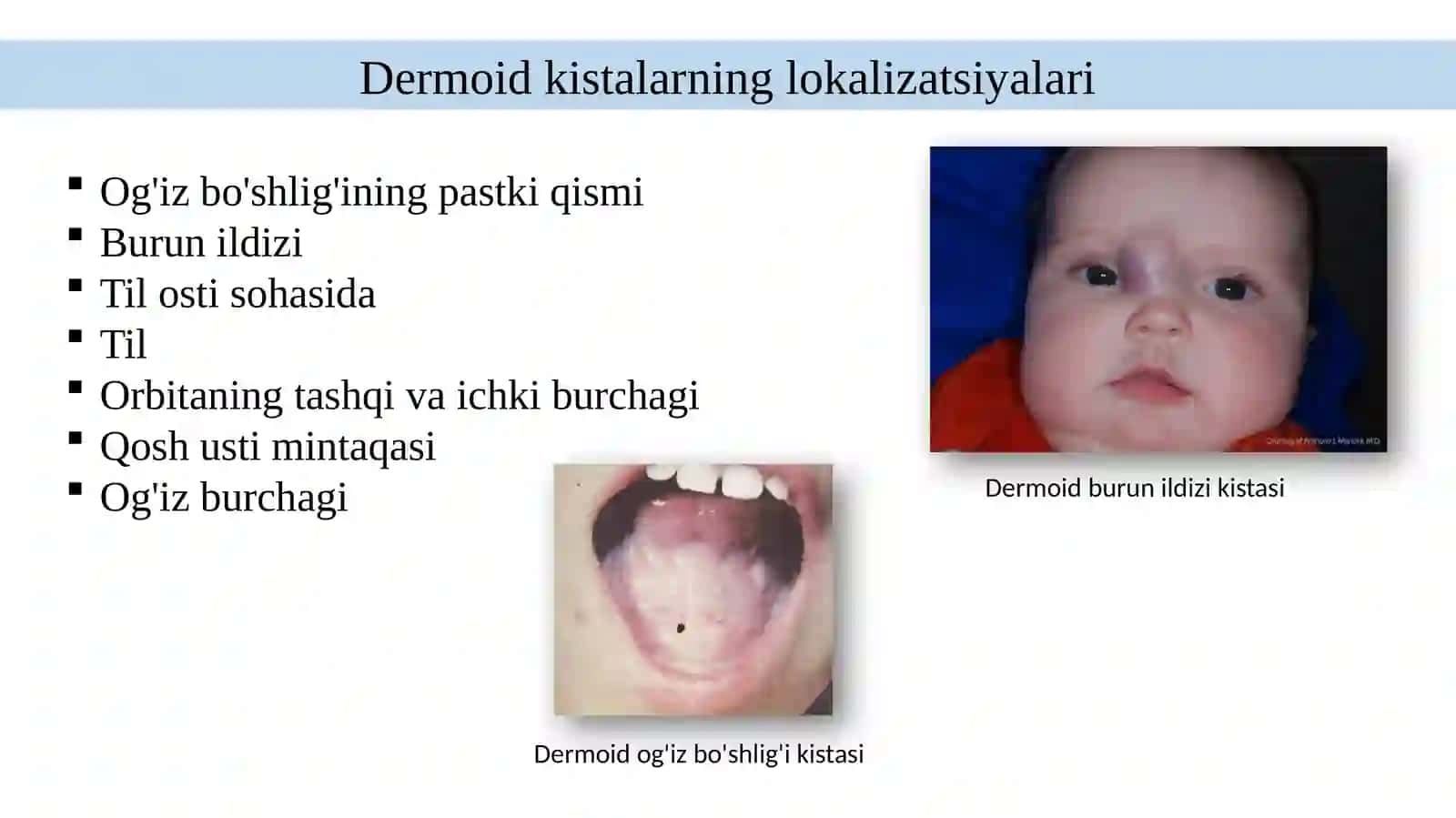 Tug‘ma kistalar (epidermoid va dermoid kistalar, yuz va bo‘yin kistalar hamda oqma yo‘llari) 4