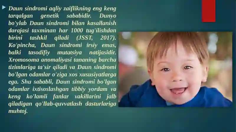 Daun sindromi 4