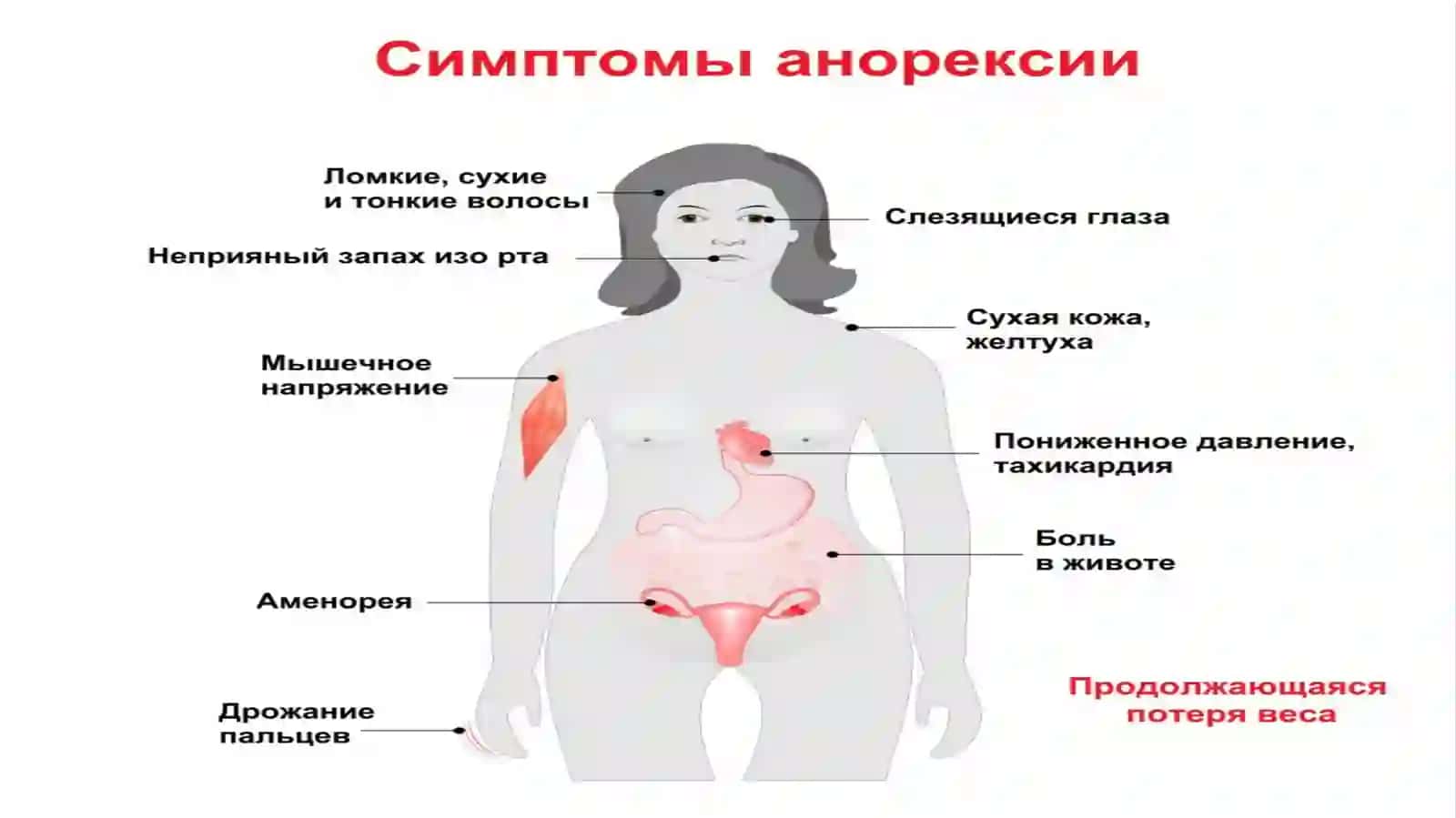 АНОРЕКСИЯ 4