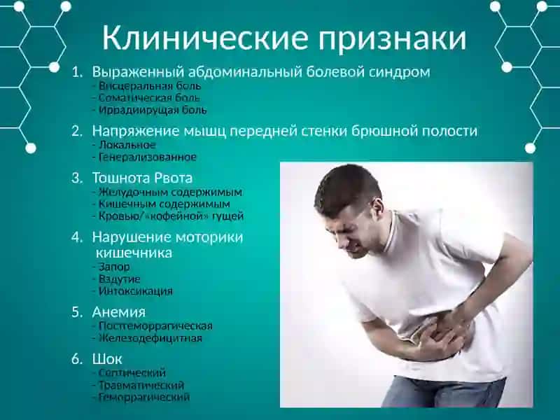 Острый живот 4