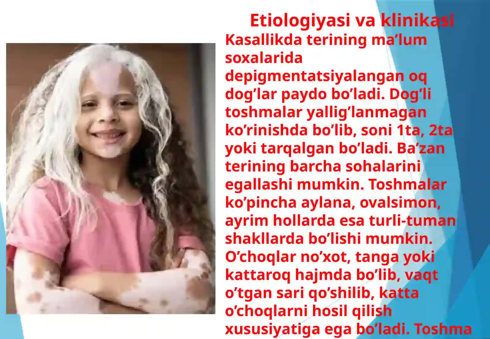 Vitiligo. Leyshmanioz. Moxov kasalligi 4