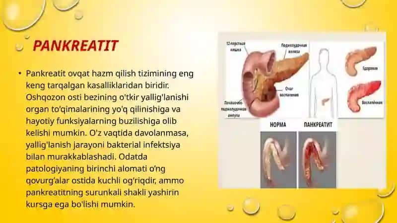 Pankreatit rivojlanishining biokimyoviy asoslari davolash va diagnostika tamoyillari 4