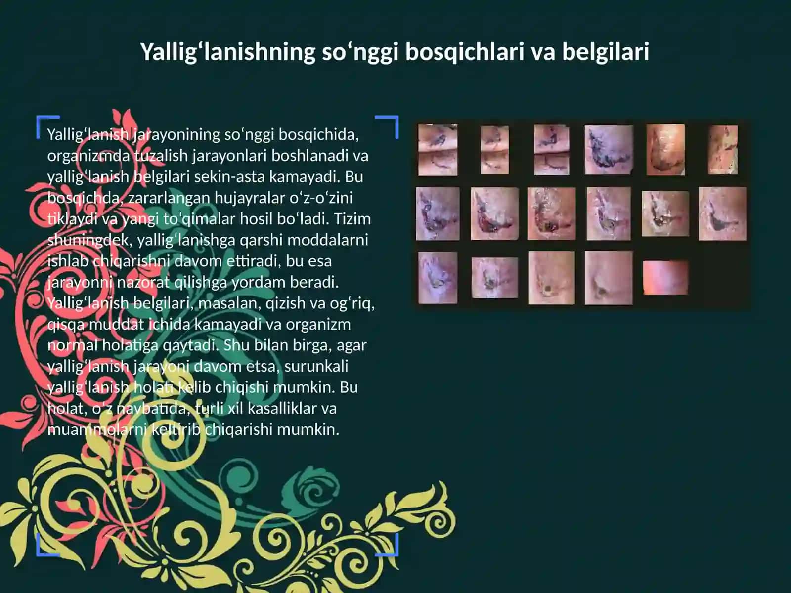 ANATOMIYA fanidan bajargan mustaqil taʼlim ishi 4