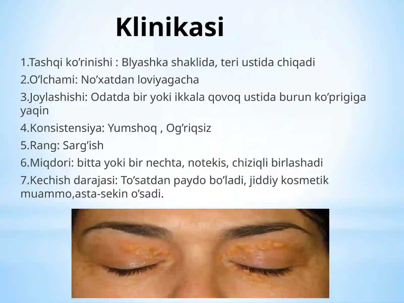Ksantelazma.Lipoma.Gigroma 4
