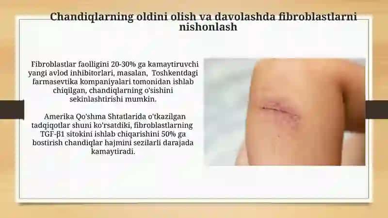 Fibroblastlarning jarohatning bitishi va chandiq xosil boʻlishidagi roli 4