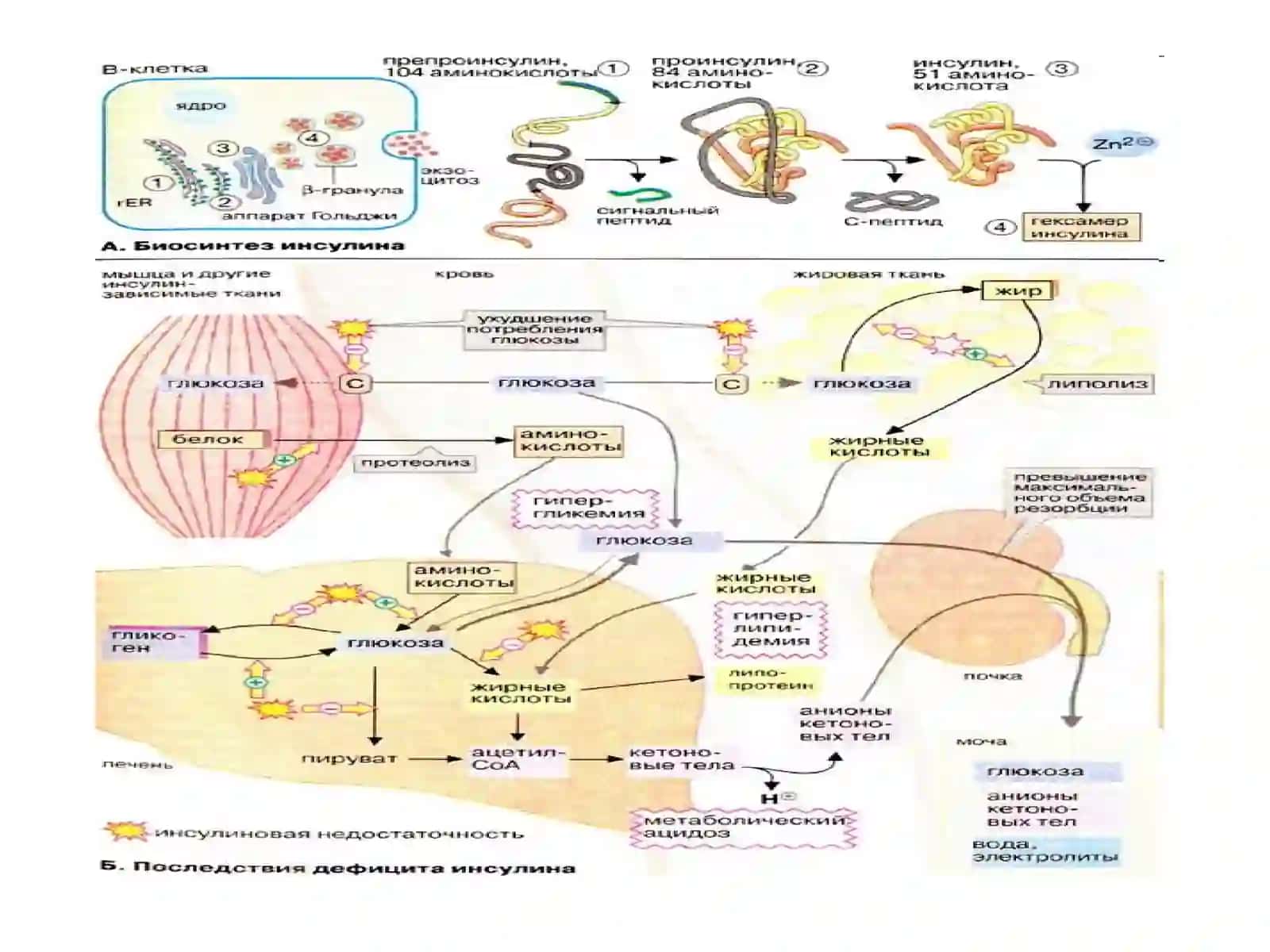 Сахарный диабет(Diabetes mellitus) 4