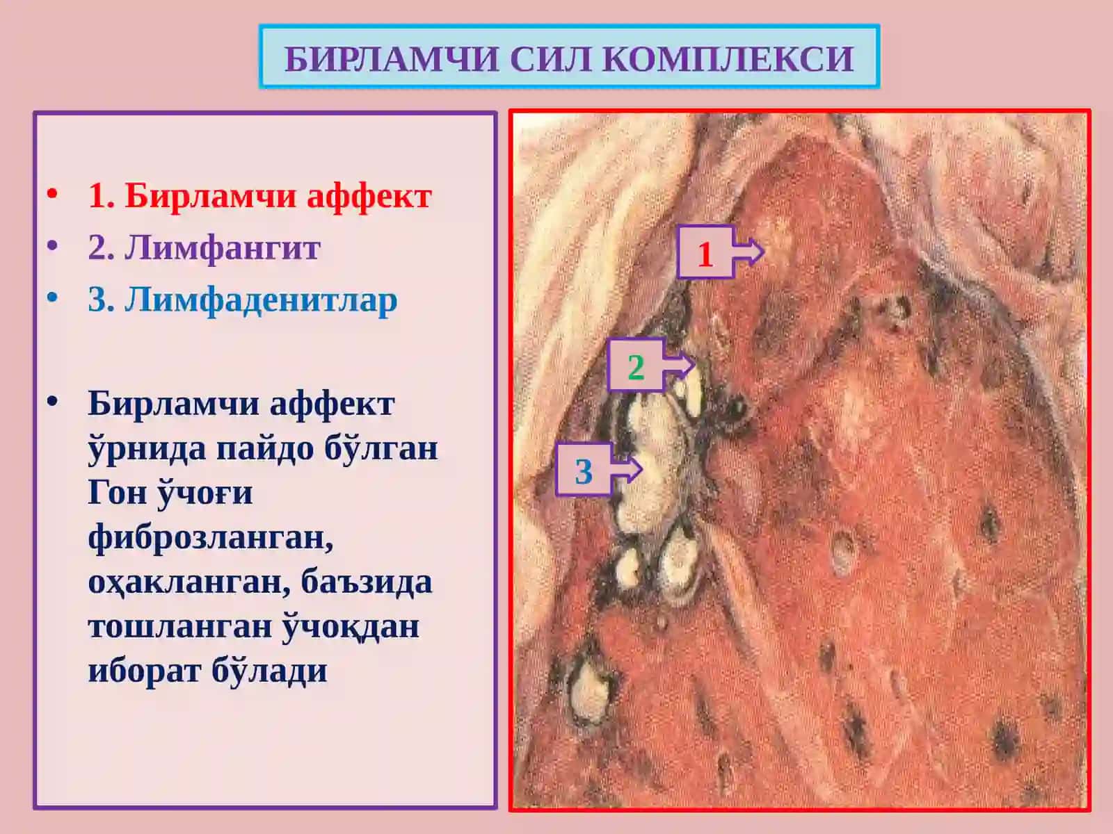 Сил 4