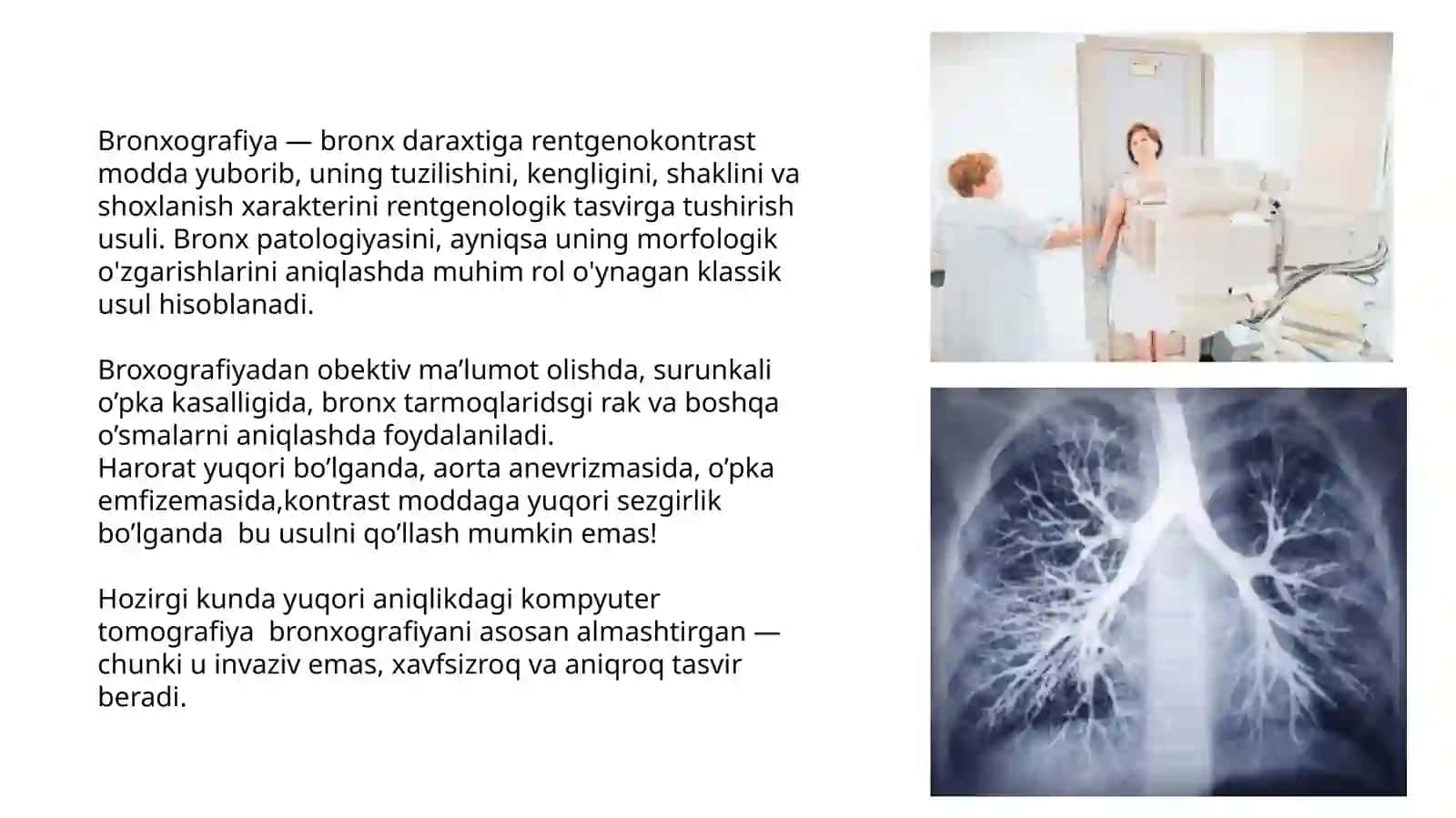 Pulmonologiya amaliyotida rentgenologik va endoskopik tekshiruvlarning o’rni: bronxografiya va bronxoskopiya. Bronxoektatik kasallik: etiologiya, patogenez, patomorfologiya, xarakterli simptomlar, og’iz bo’shlig’ida o’ziga xos o’zgarishlar parhez va medikamentoz davolash. 4