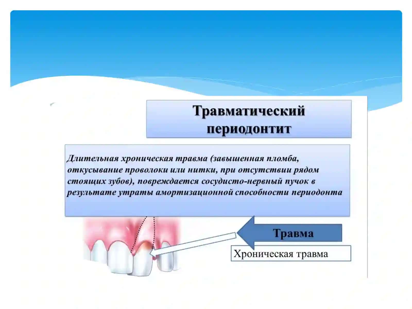 Хронические формы периодонтитов классификация клиника,диагностика 4