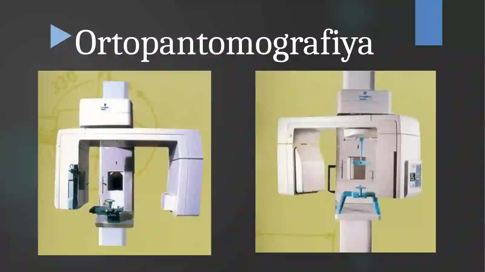 Rengenologik tekshiruv usullari. Ortopantomografiya, tomografiya, 3D va Telerentgenografiya asoslari. 4