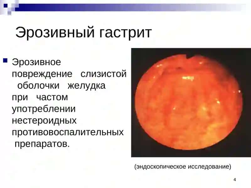 Курс патологической анатомии 4