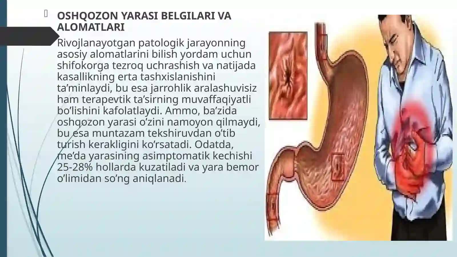 OSHQOZON YARA KASALLIGI ETIOPATOGENEZI 4