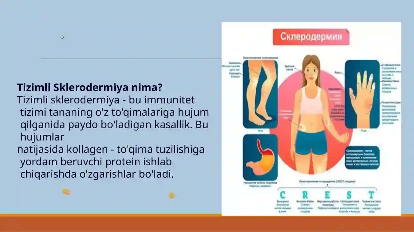 Tizimlisklerodermiya 4