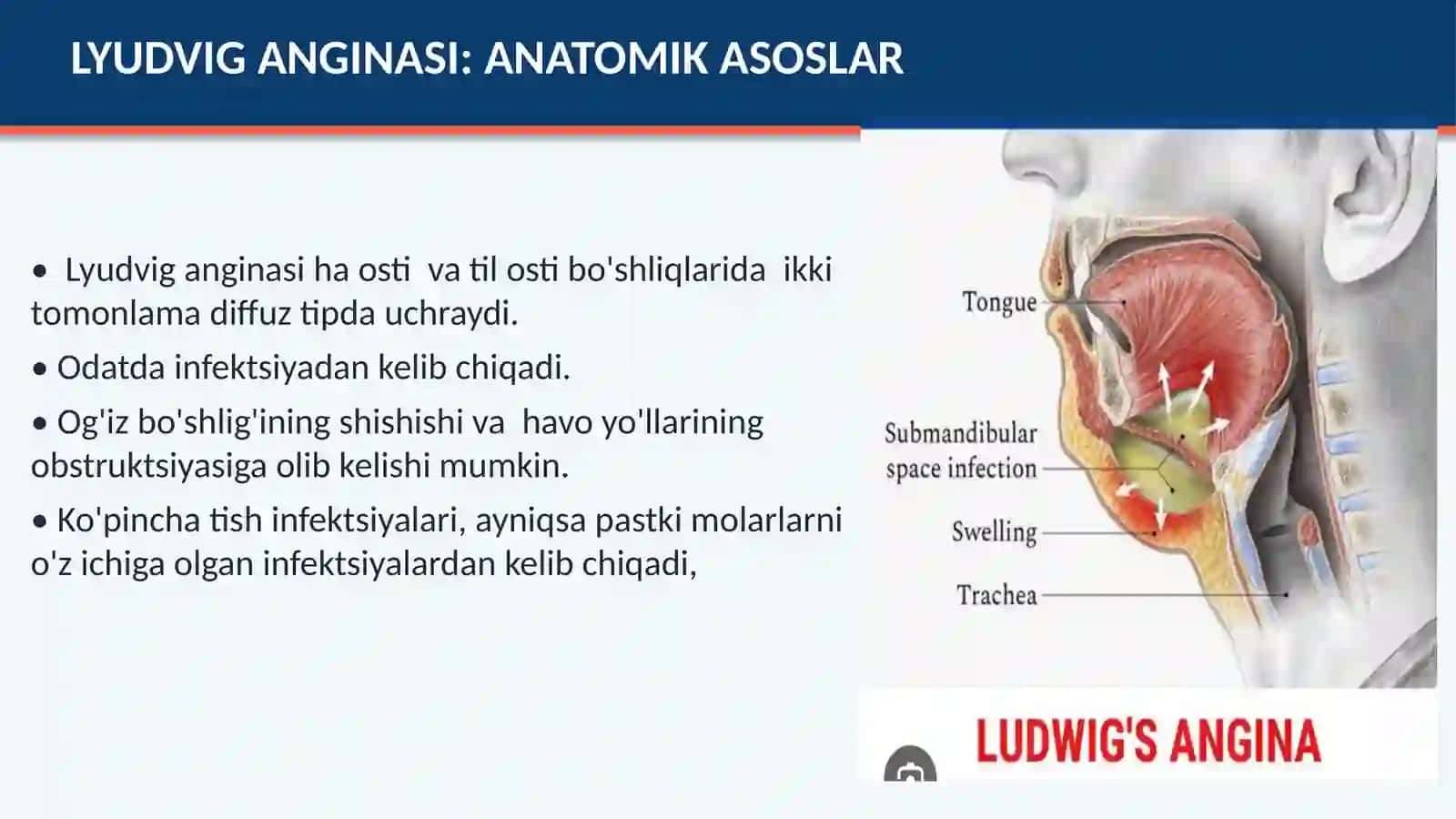 LYUDVIG ANGINASI VA PARAFARINGEAL XO'PPOZ 4