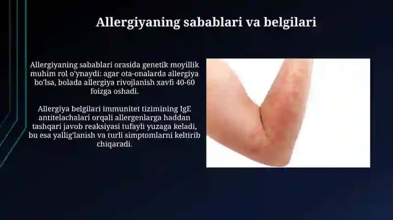 Allergiya 4