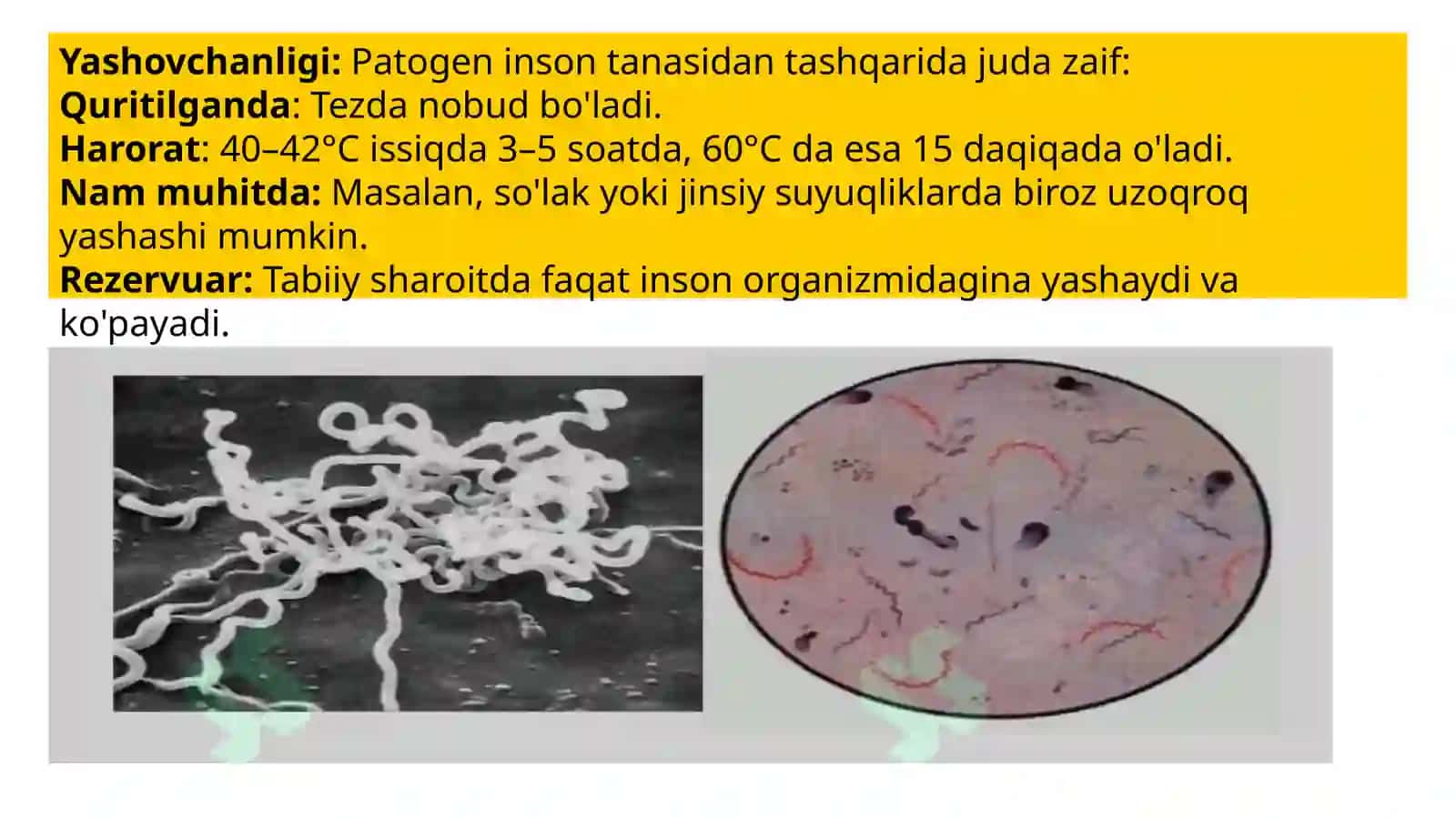 Zahm,qaytalama tif va leptosiporoz qoʻzgʻatuvchilari 4