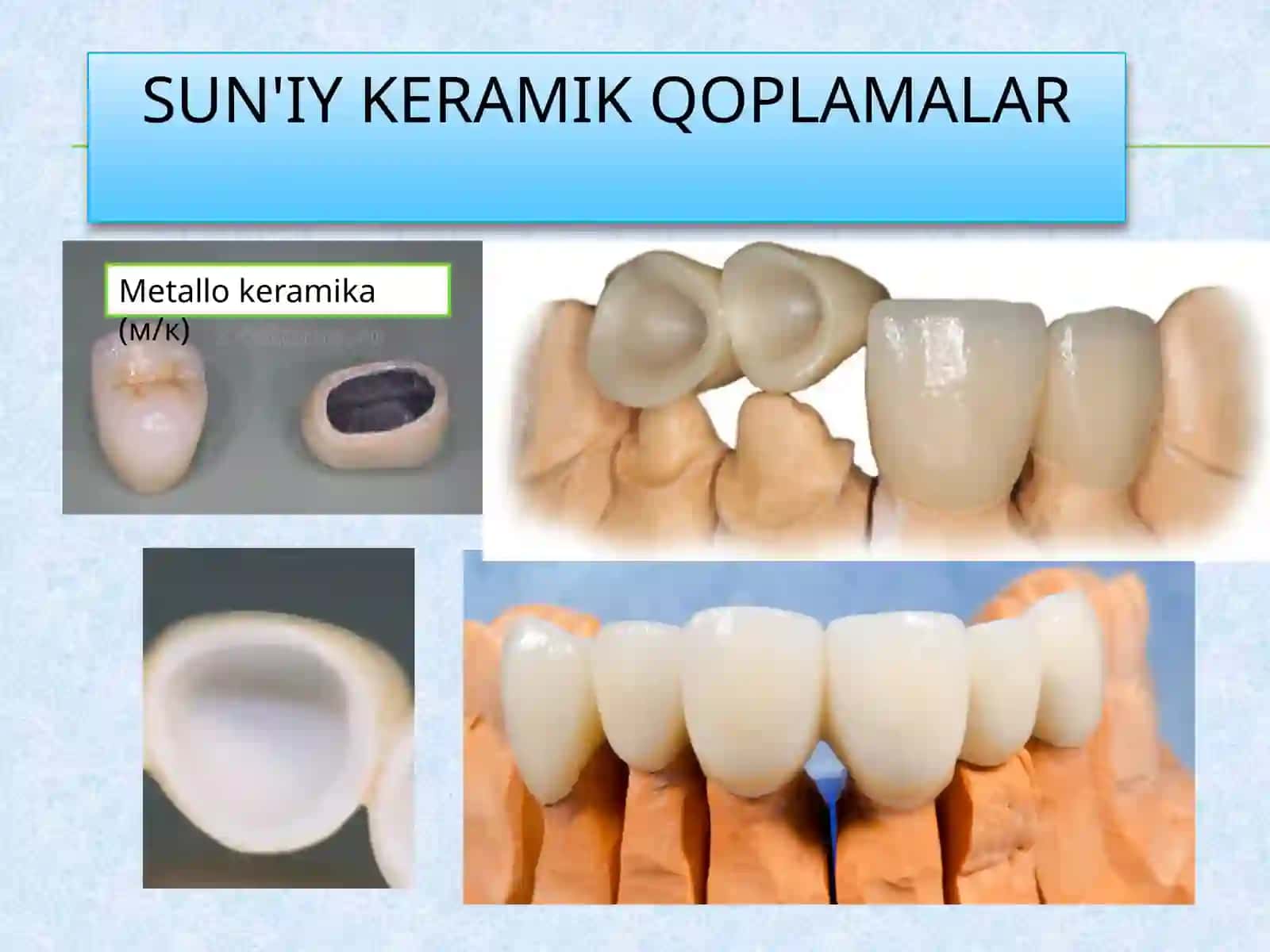 Sirkoniy dioksid stomatologik keramika farfor 4