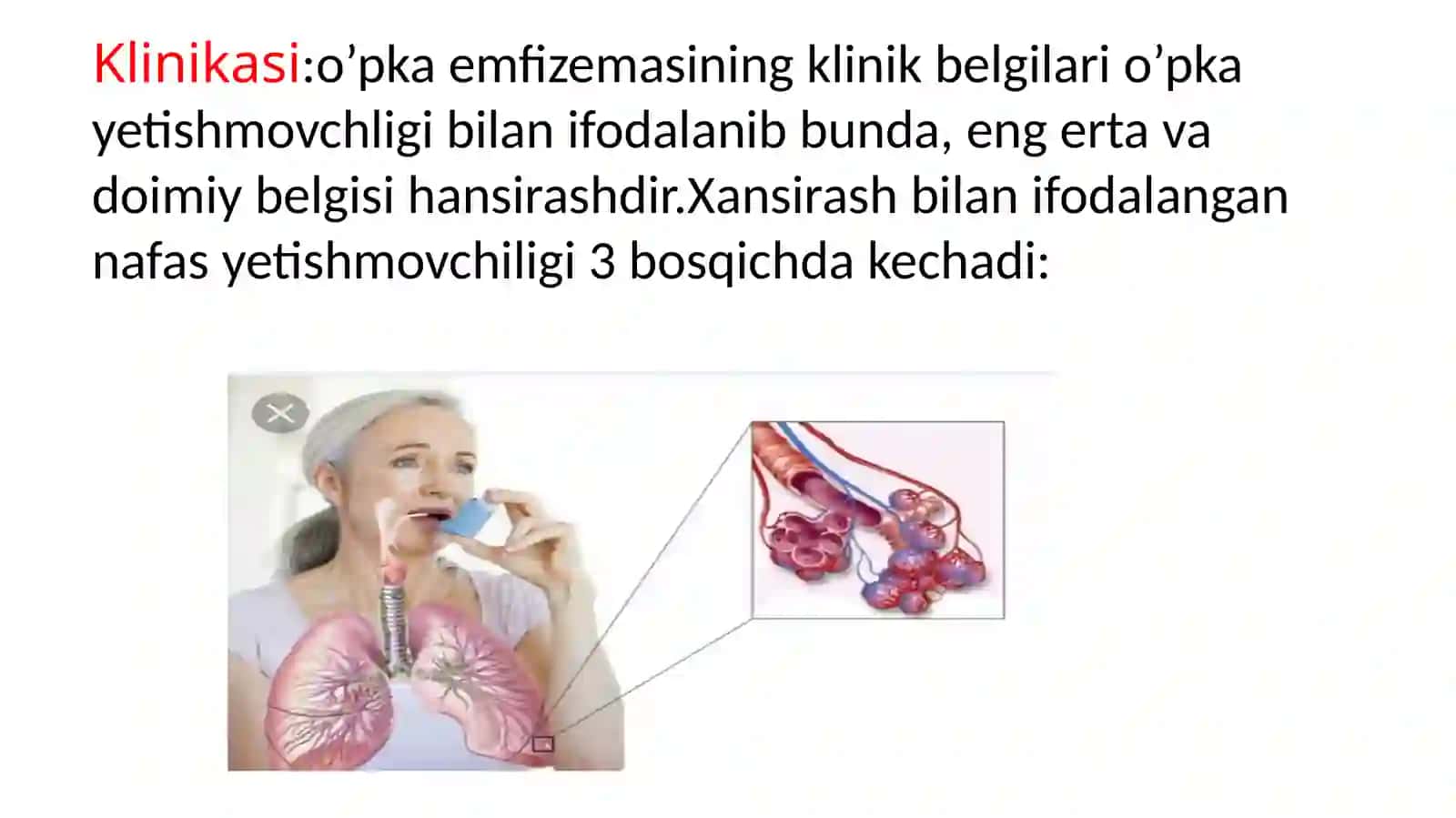 O’PKA EMFIZEMASI 4