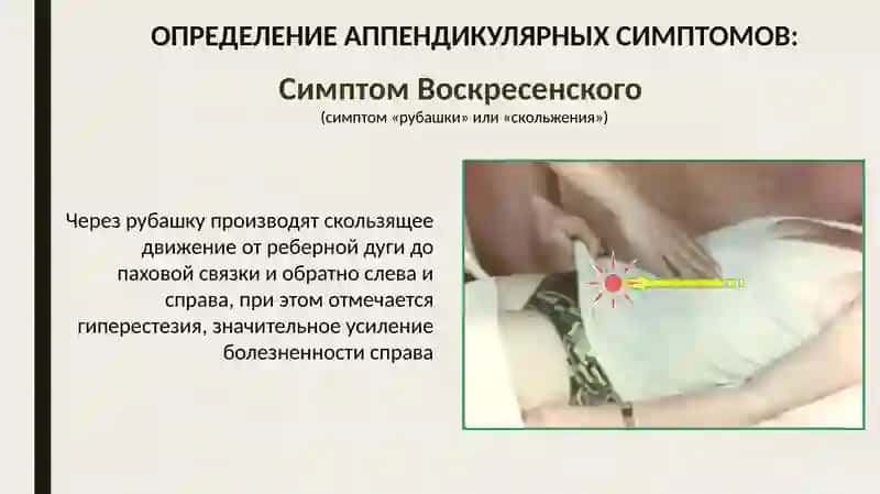 Ректальное исследование при тазовом аппендиците 4