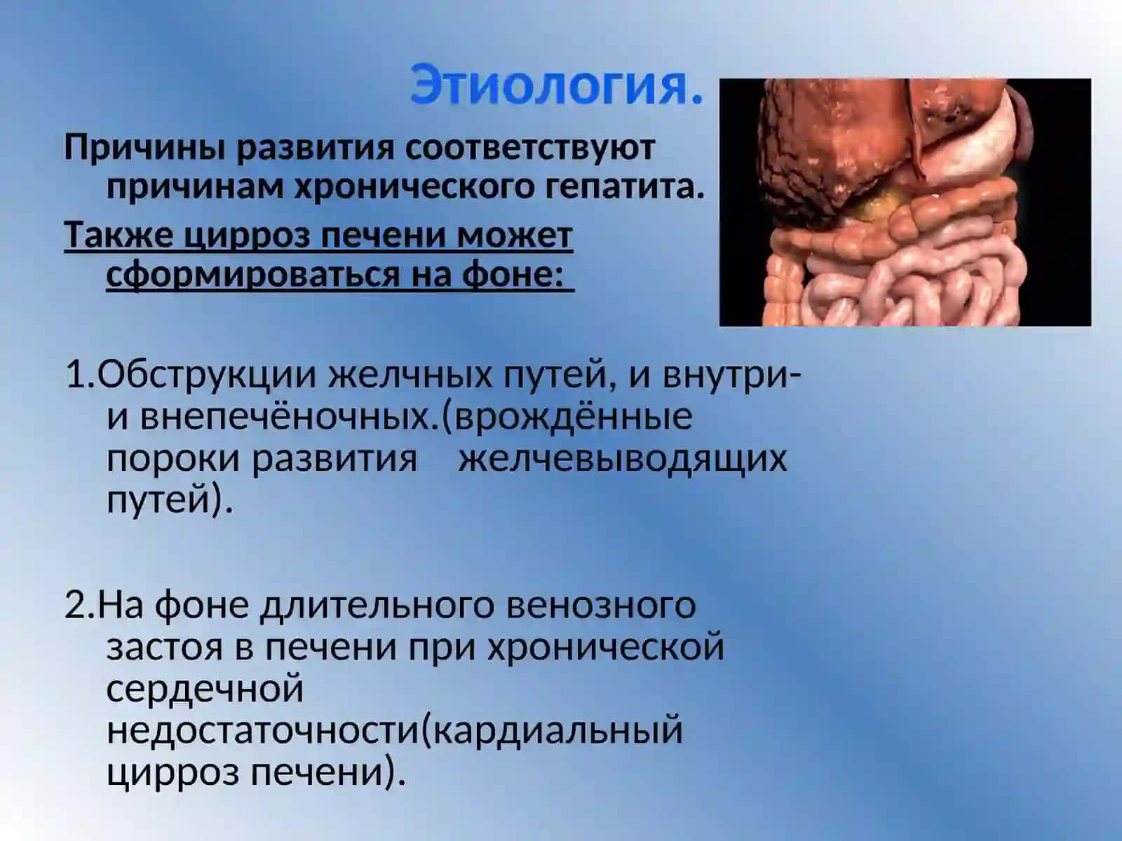Цирроз печени 4
