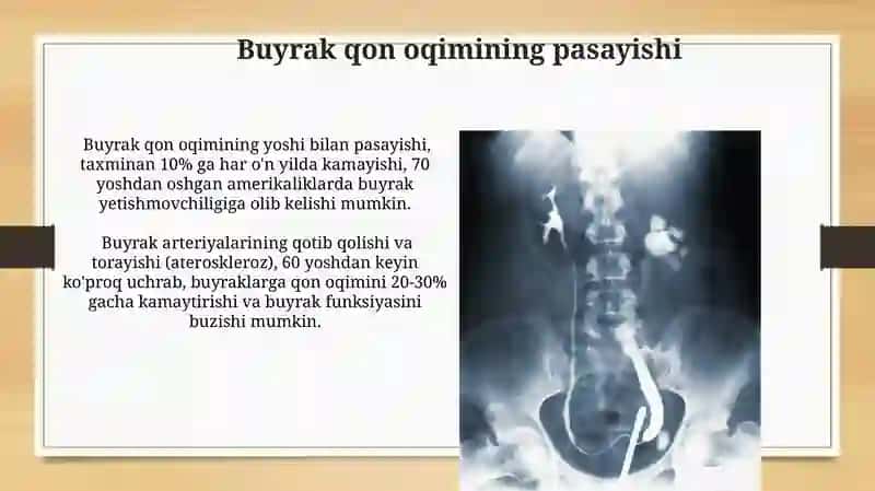 Siydik pufagi 4