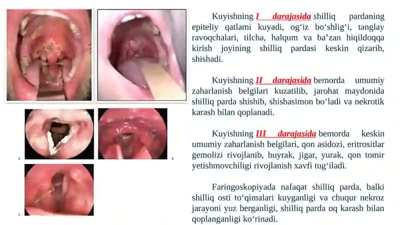 HALQUM KUYISHLARI 4