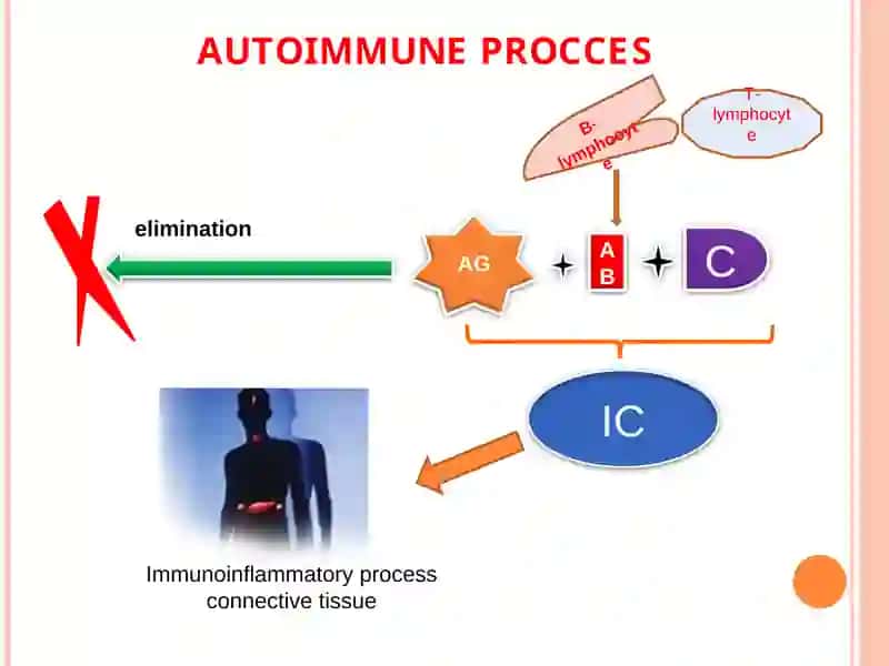 Differential diagnosis of Diffuse Connective Tissue Diseases 4