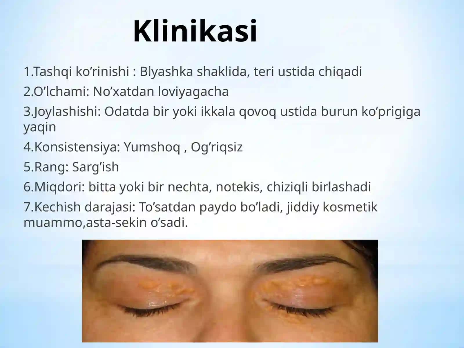 Ksantelazma.Lipoma.Gigroma 4
