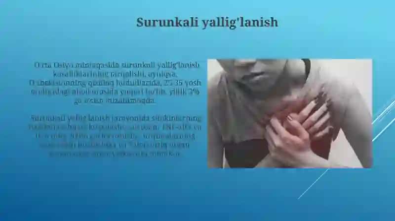 Yalligʻlanish va immunitet tizimi 4