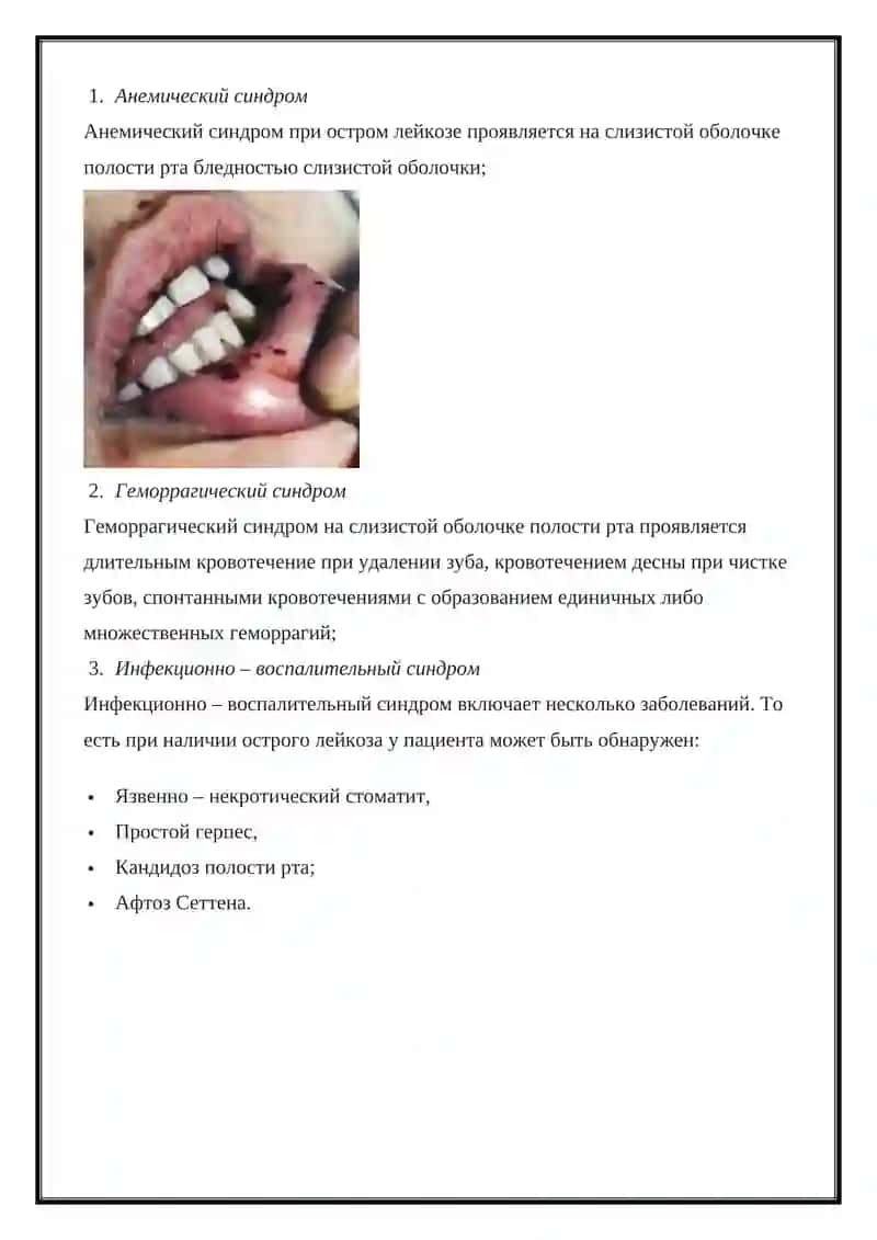 Гемобластозы 4