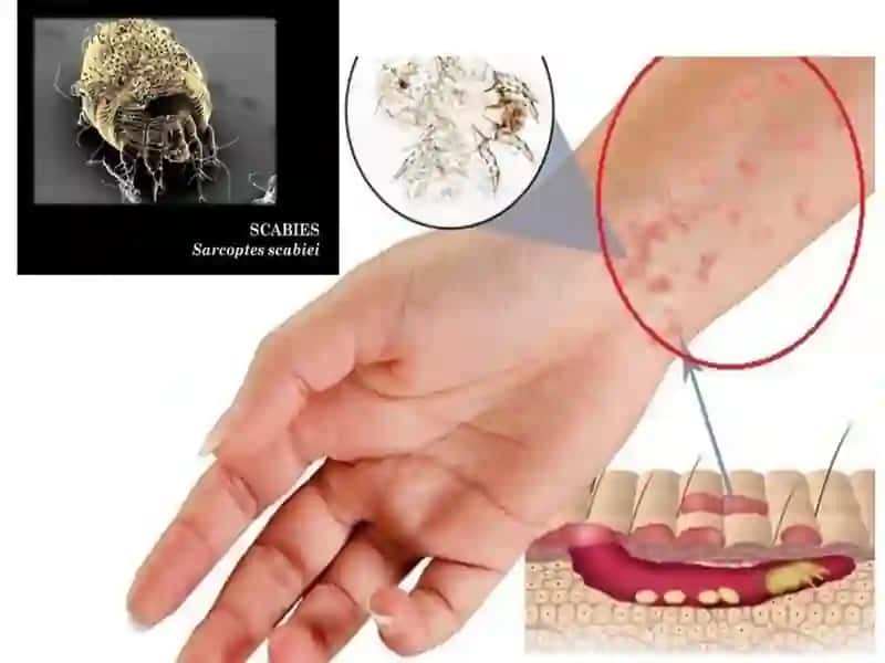 Терининг паразитар касалликлари 4