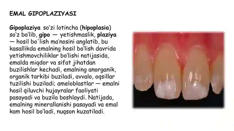 nokarioz kasalliklar 4