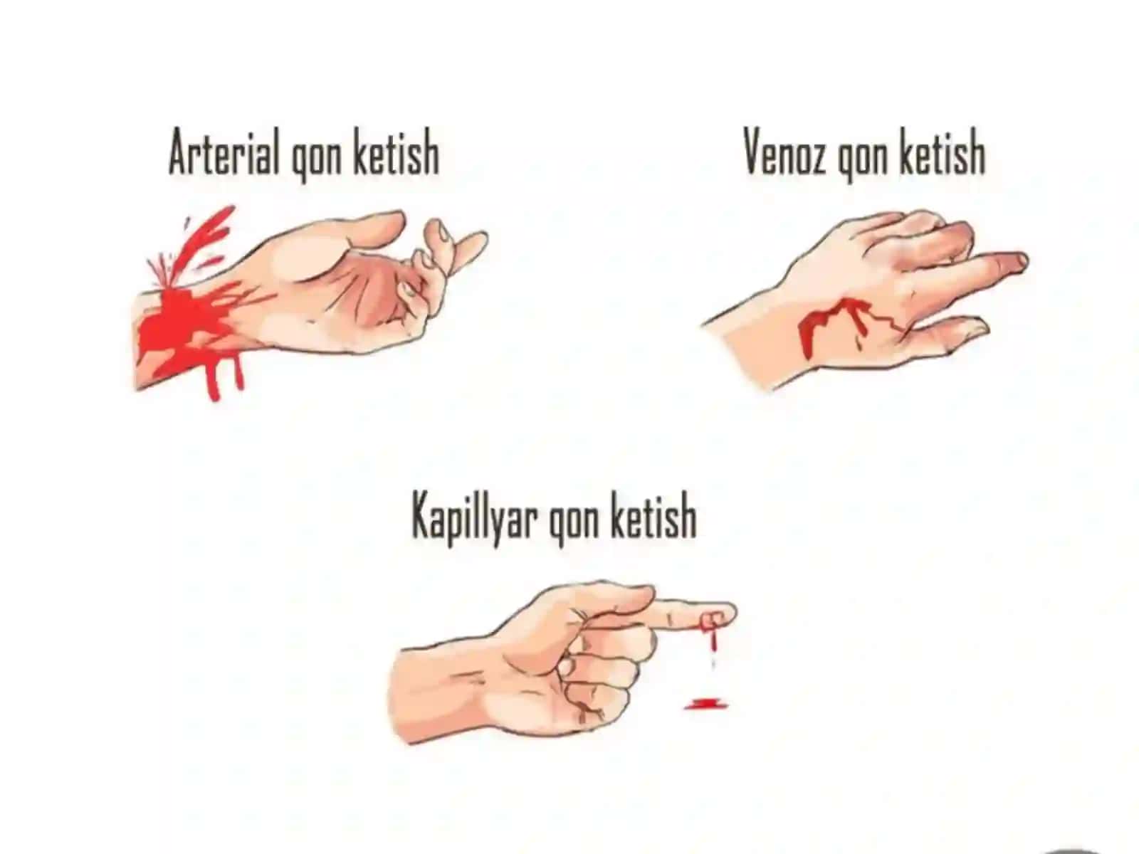 Qon Ketish Va Birinchi Yordam Ko`rsatish 4