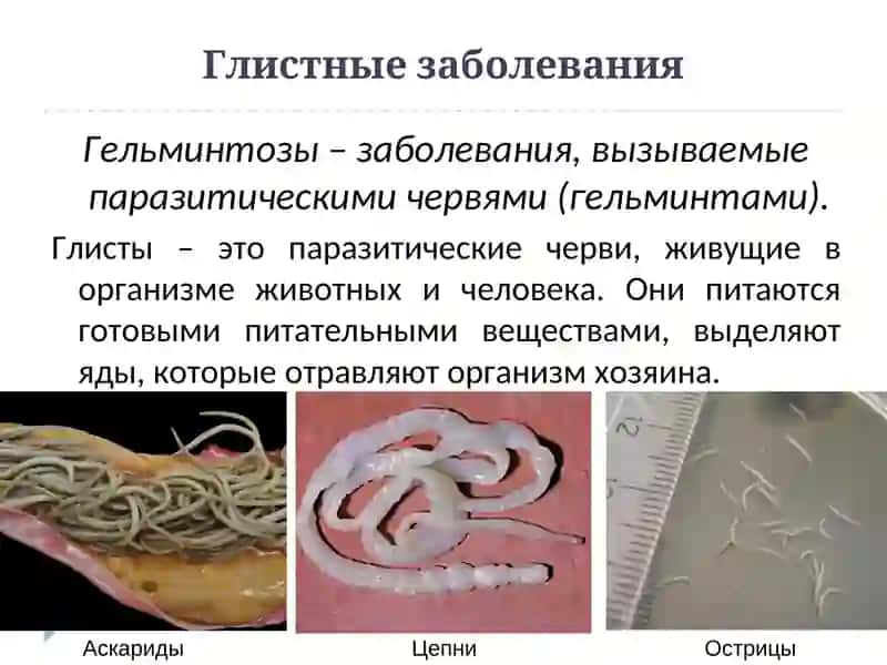 Заболевания органов пищеварительной системы 4