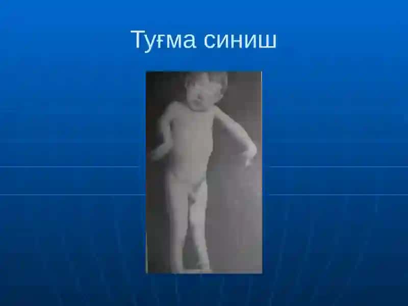 Суякларнинг синиши ва чикиши 4