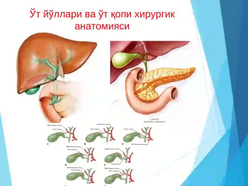 Ўт тош касалликлари 4