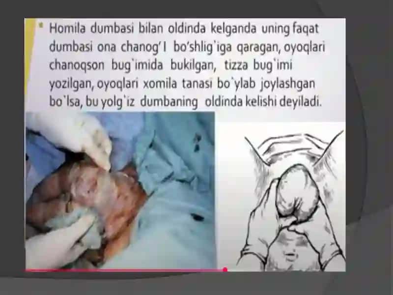 Homilaning chanog’i bilan kelishi 4