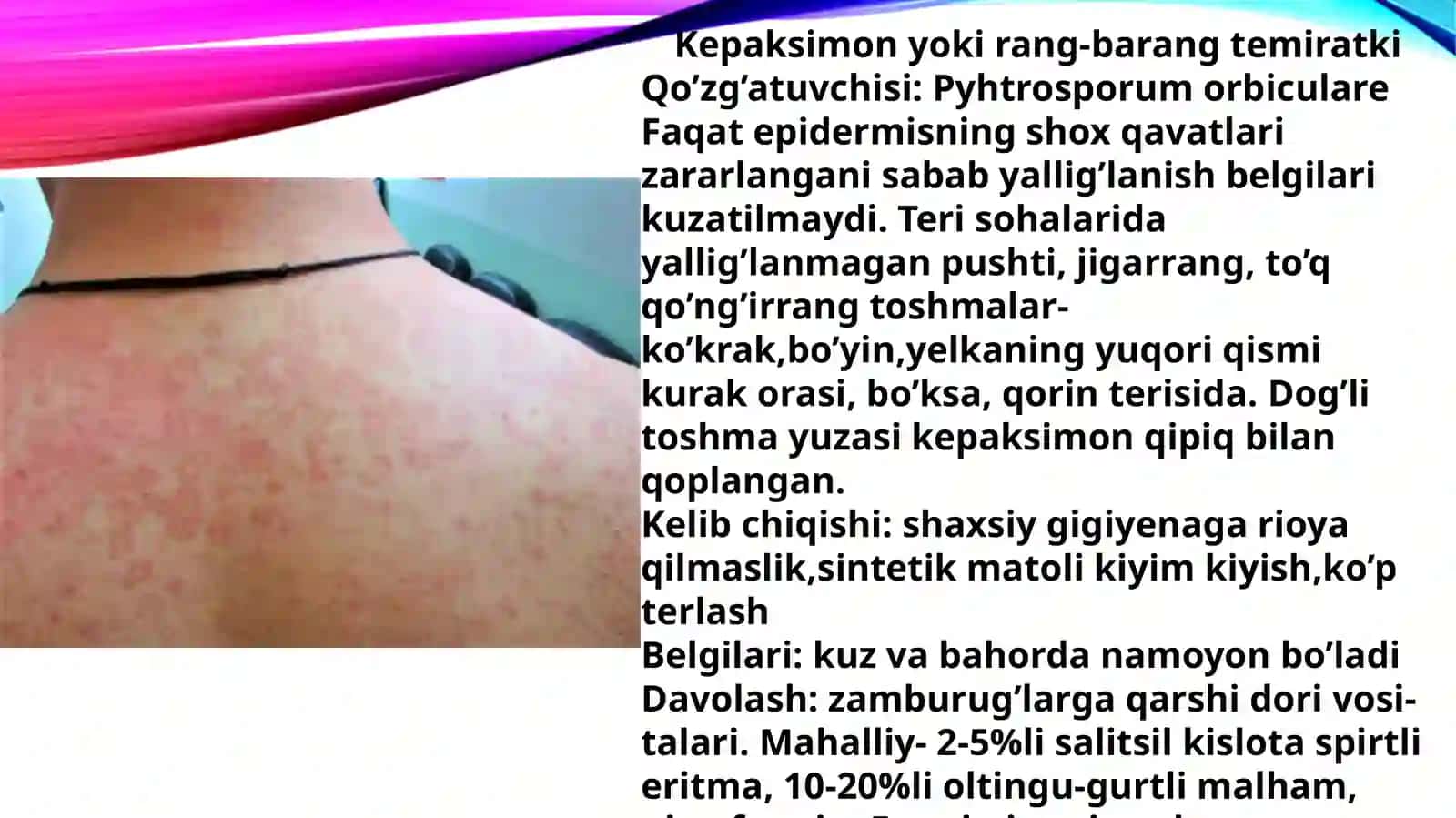 Terining zamburug'li kasalliklari 4