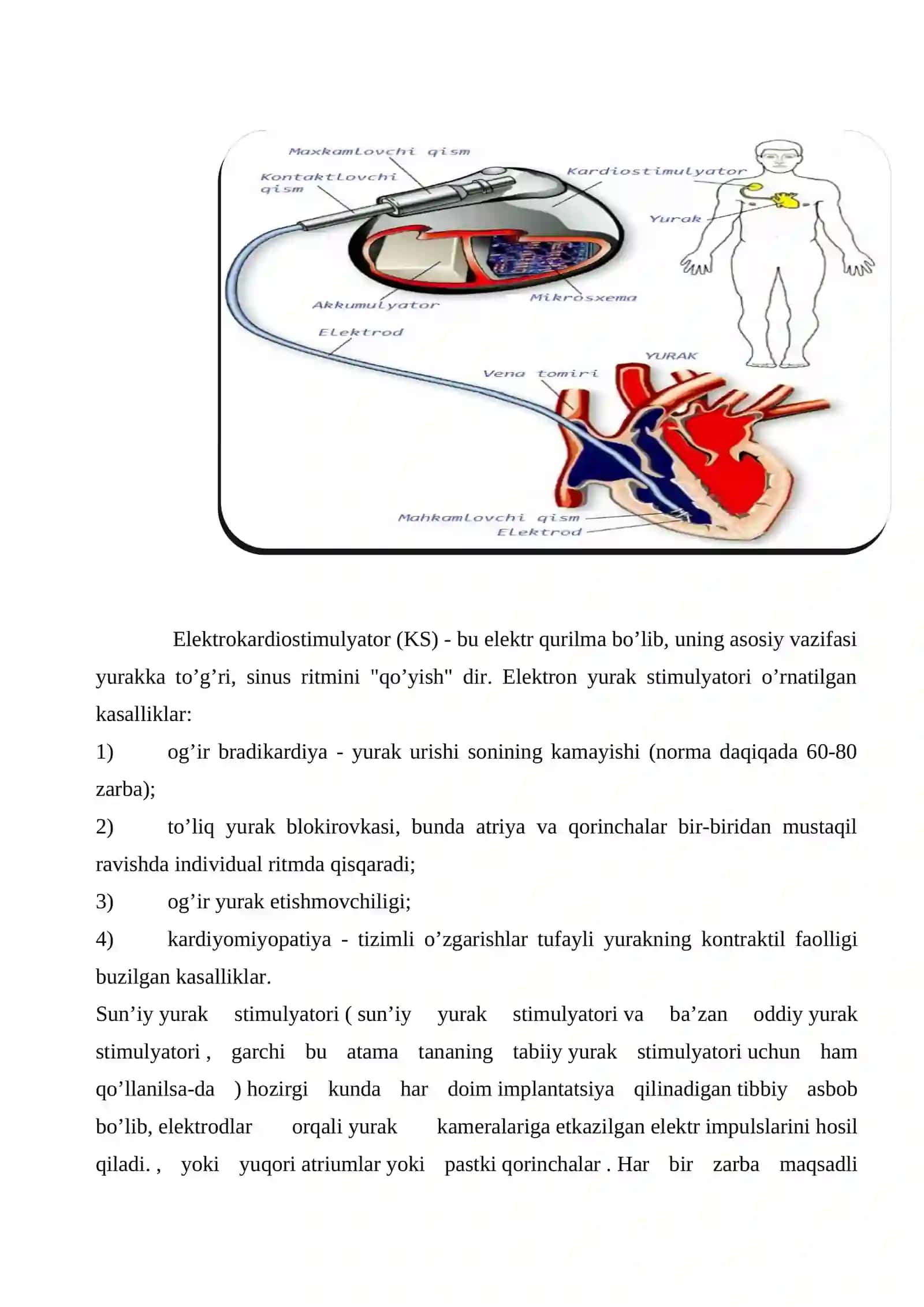 Kardiostimulyatorlar 4