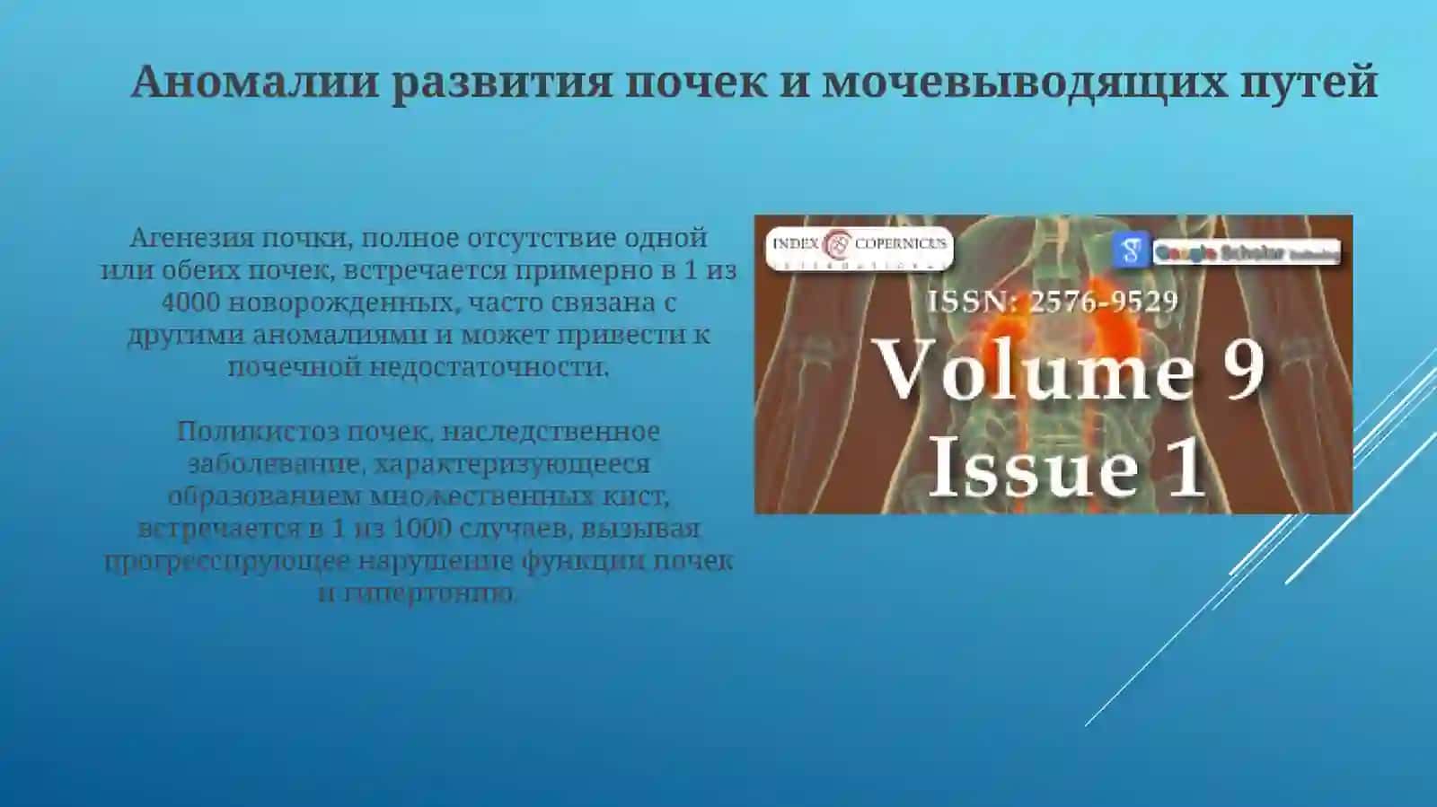 Презентация Заболевания почек. Аномалии развития. Гломерулопатии 4