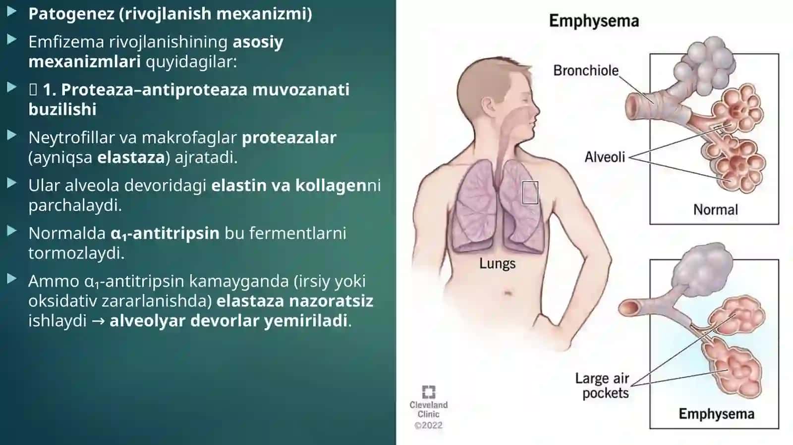 Etiologiyasi(sabablari) 4
