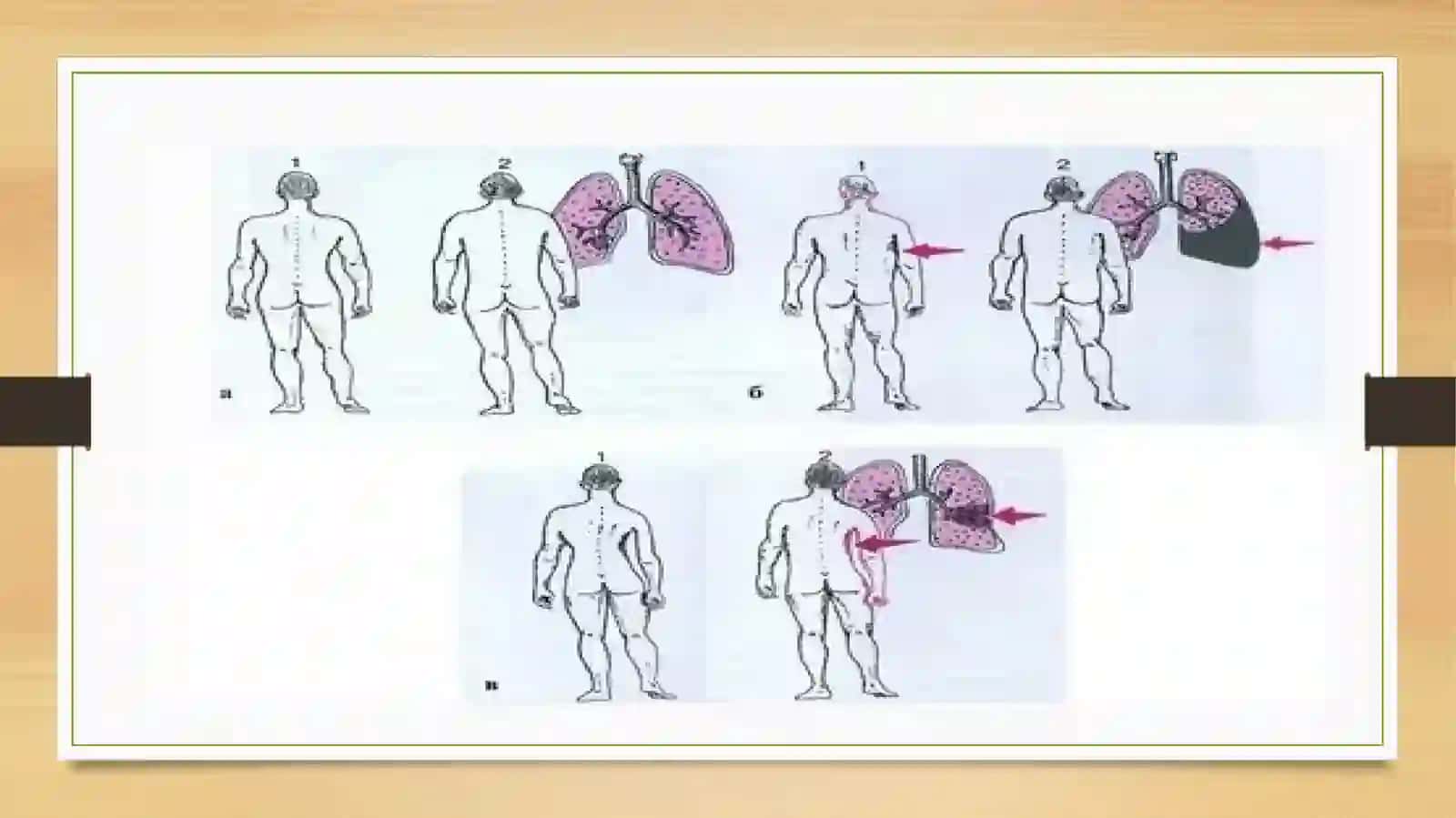 O’pkayoki ko'krak qafasi ekskursiyasi 4