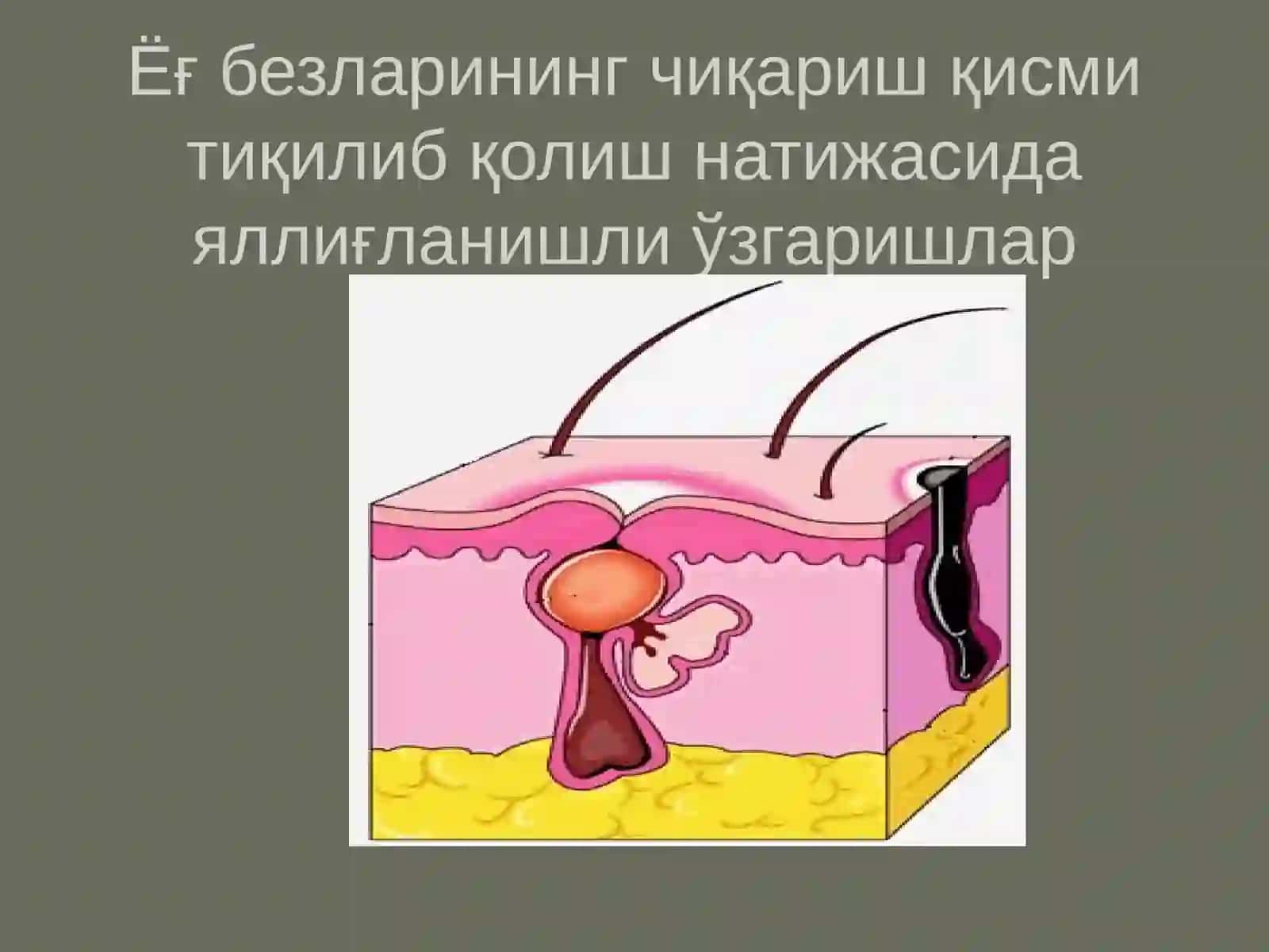 Хусунбузарлар (угри) 4