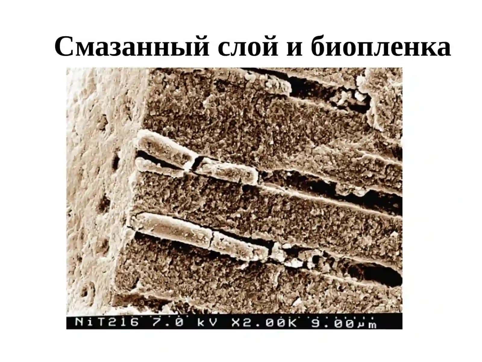 Ирригации корневых каналов 4