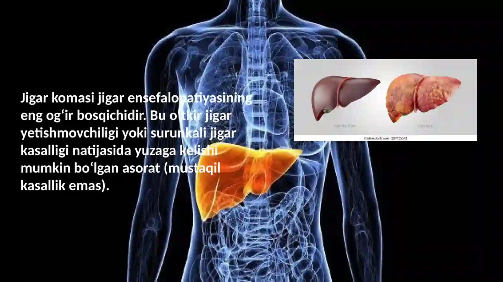 Pediatriya ishi 2-kurs talabasi Sa'dullayev Samariddin 4