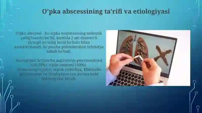 O'pkada bo’shliq sindromi (O'pka abstsessi va bronxoektaz ) Asosiy davolash prinsiplari 4
