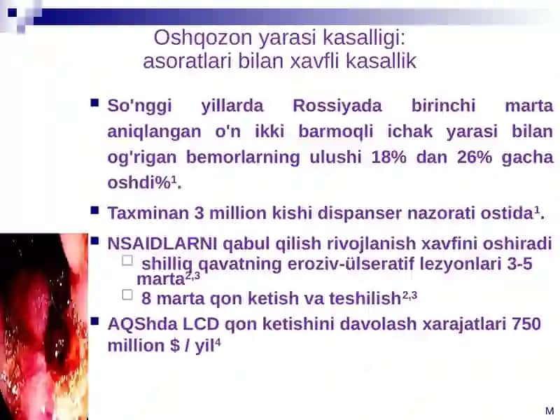 Oshqozon yarasi kasalligi 4
